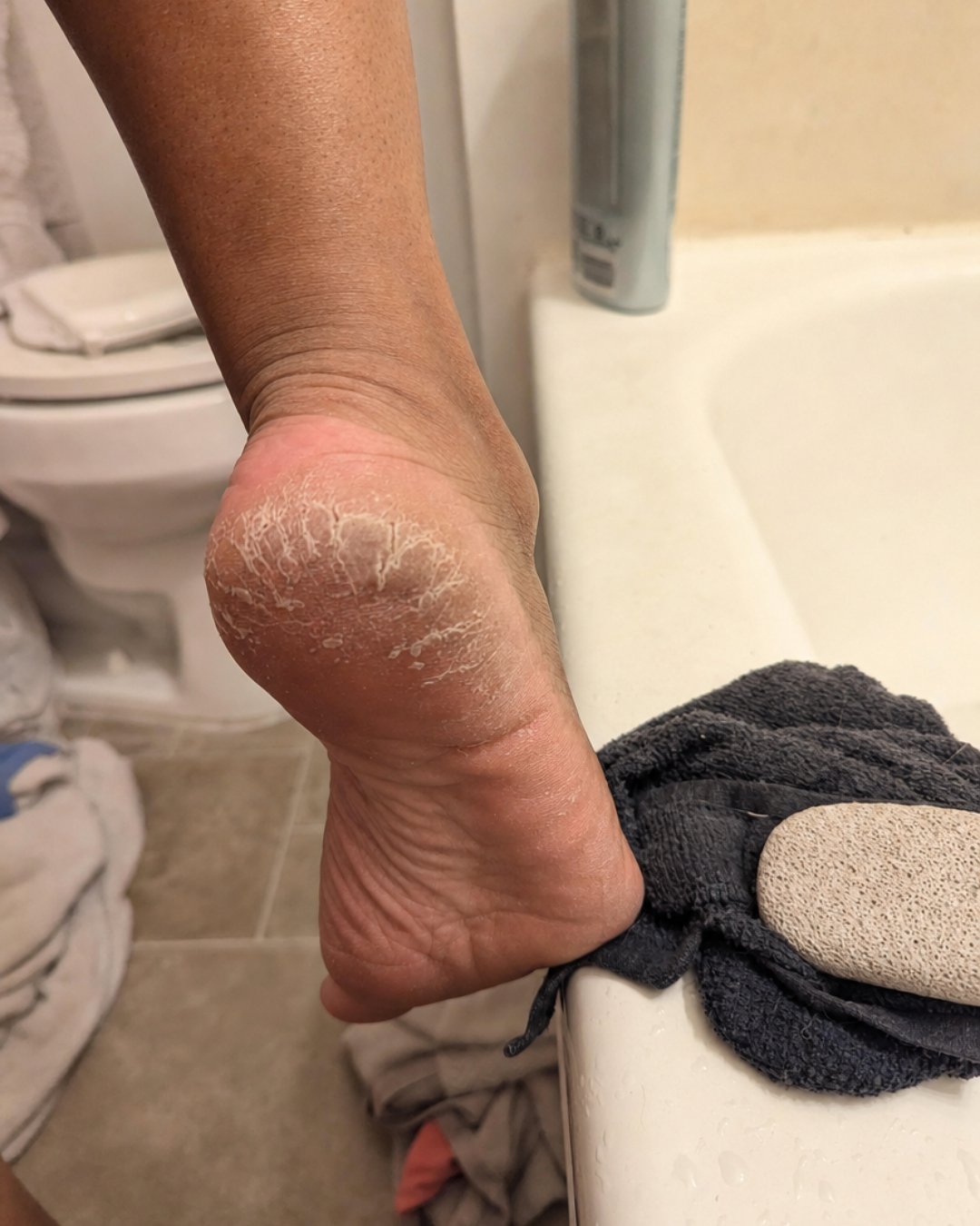 FOOT PIC.jpg