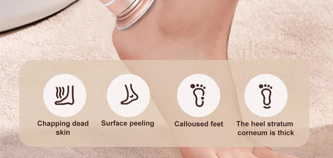 Kenzova Electric Callus Remover for Silky Smooth Feet