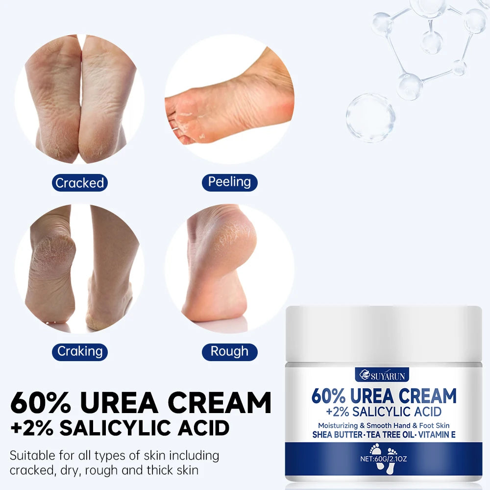 Fast Action 60% Urea Foot Cream – Heal Cracked Heels in Days